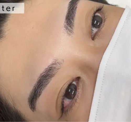 施術後の眉（ケース1）