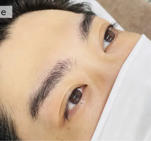 施術前の眉（ケース1）